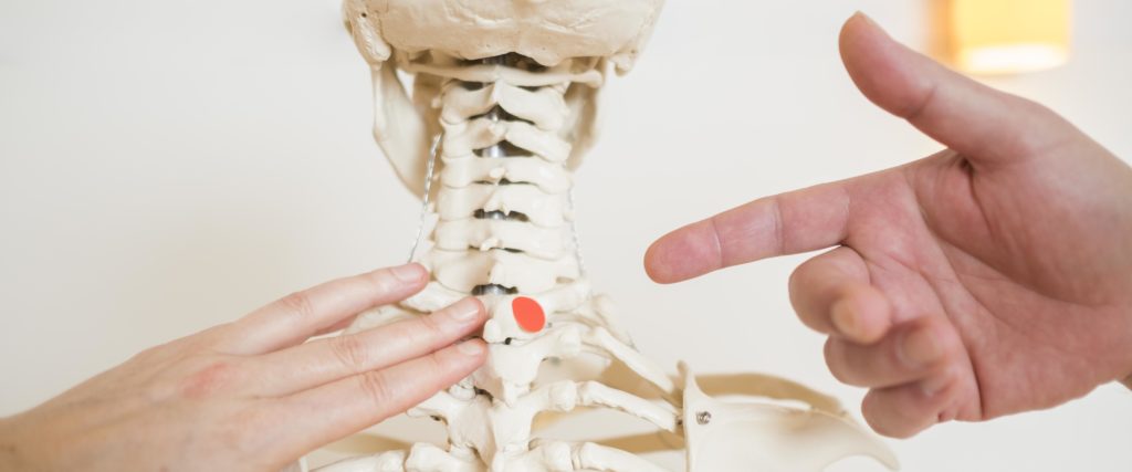 Chronische Kopfschmerzen und Nackenbeschwerden mit sanfter Chiropraktik ...